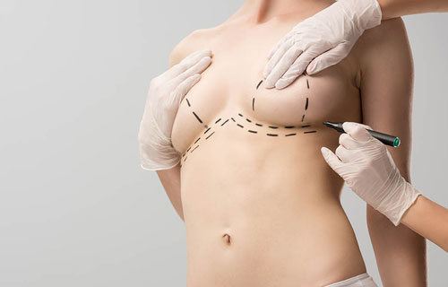 Breast-lift-in-Iran
