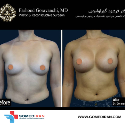 Dr. Farhood Goravanchi Before and afters