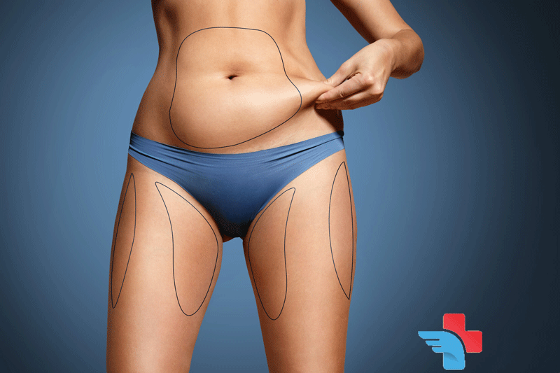 Body Contouring & Slimming - Cosmic College