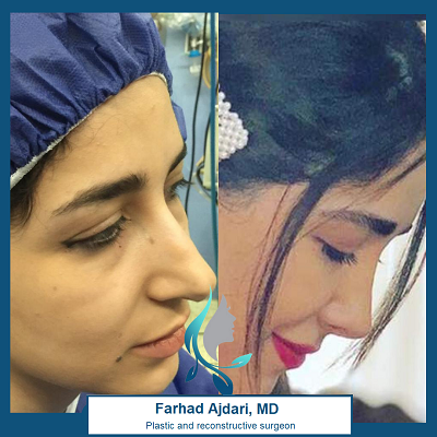 Dr. Farhad Ajdari Before and afters