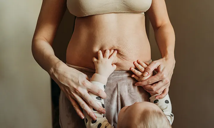 Dealing with Loose Skin After Pregnancy