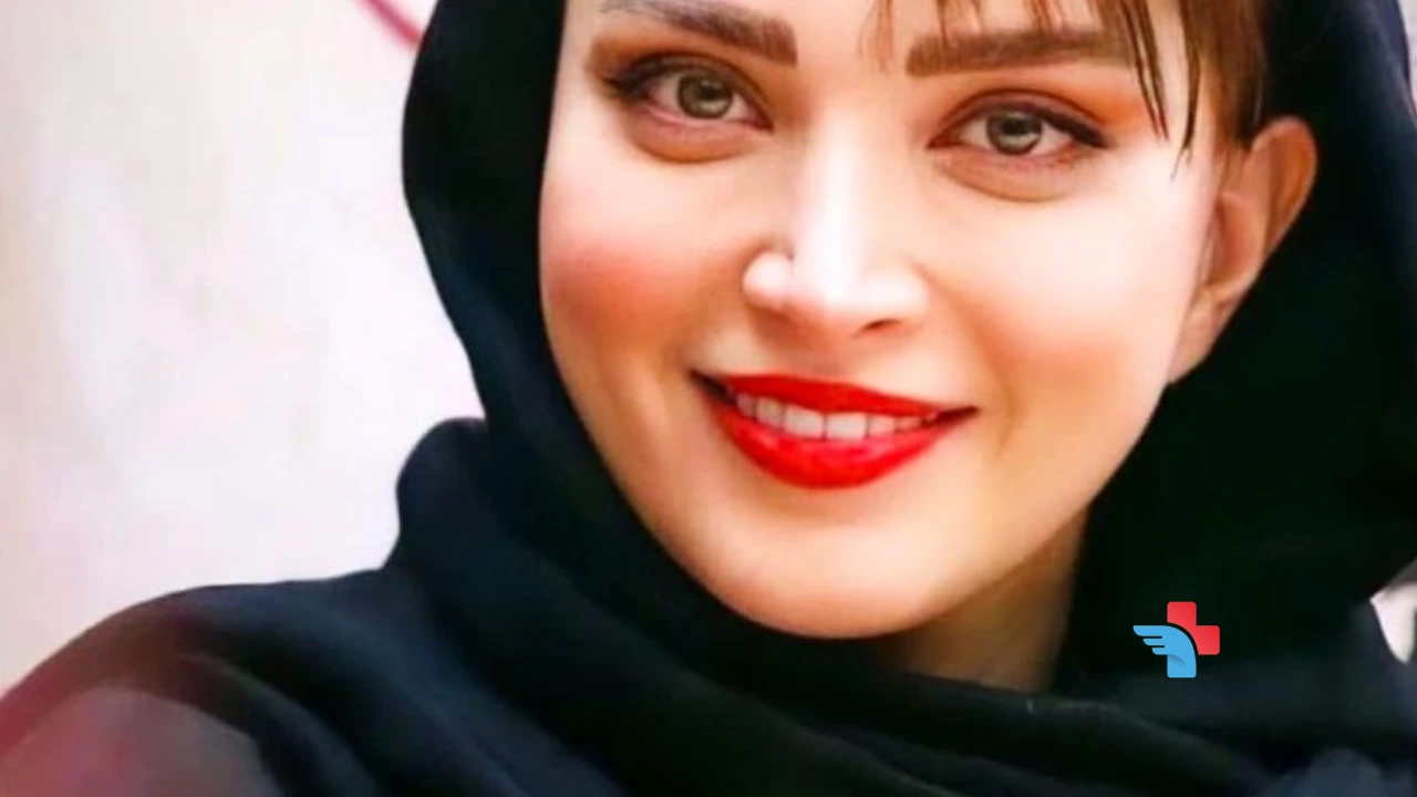 How the Iranian Nose Job Became a Global Phenomenon