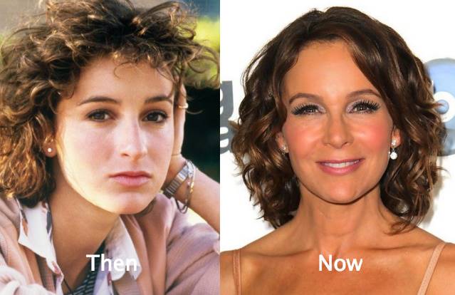 Jennifer-Grey-Plastic-Surgery