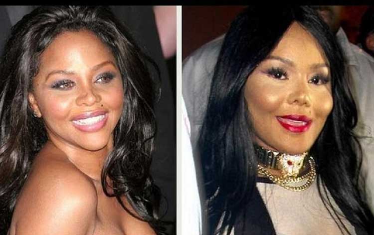 Lil' Kim plastic surgery