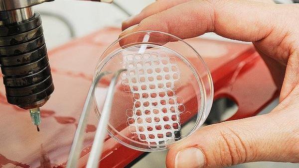 Stem Cell-Based Tissue Engineering: