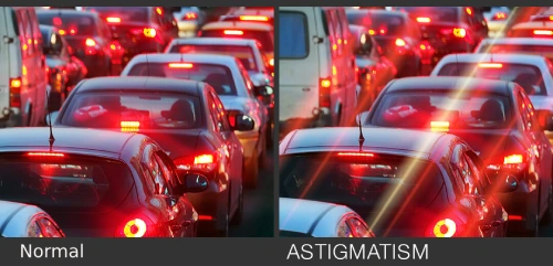 Understanding Astigmatism