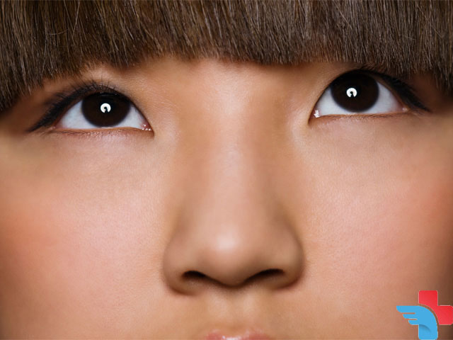 What is Asian nose job?