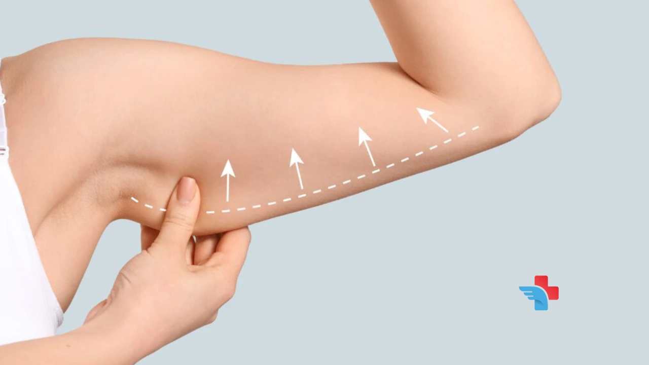 arm liposuction