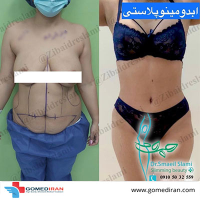 Dr. Esmaeil Eslami Before and afters