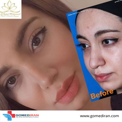 Dr. Sajad Mohammadi Before and afters